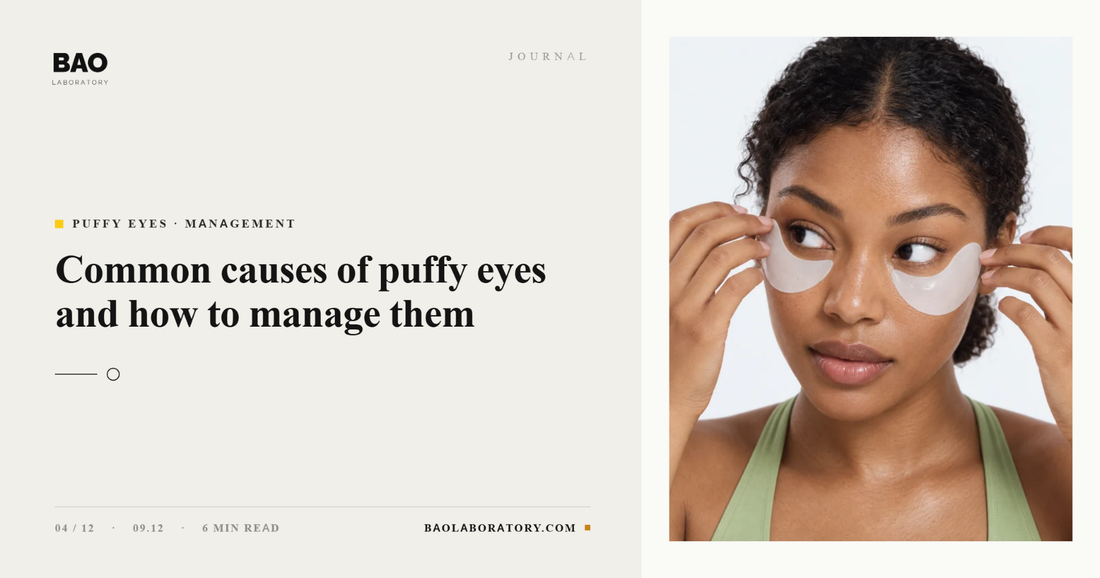 Common Causes of Puffy Eyes and How to Manage Them