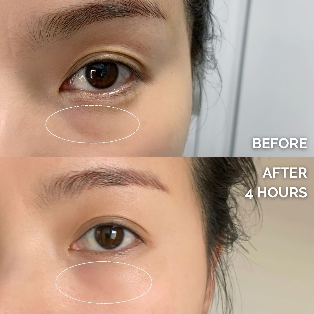 Instant Renewal Eye Bundle