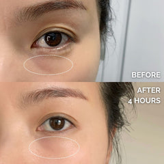 Instant Renewal Eye Bundle